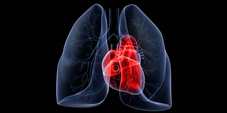 COPD - Chronic Obstructive Pulmonary Disease